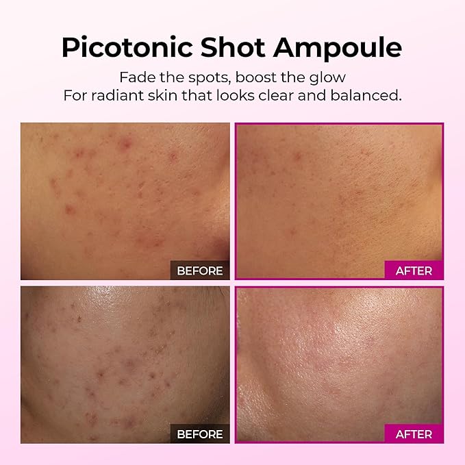 Dr.Melaxin Cemenrete Picotonic Shot Calcium Serum for Firming Density collagen serum Even Skin Tone &amp Skin Clarity Anti-aging Dark spot care 1.01 fl.oz.