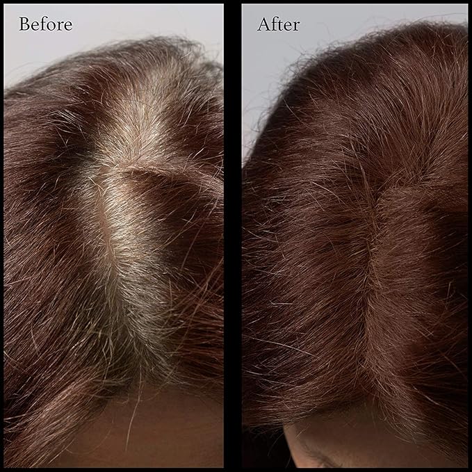 Hair Root Touch Up Powder - Dark Auburn - 11 True-to-Nature Root Concealer Shades - Long-Lasting Clean Fragrance Free Talc &amp Paraben Free - For Women &amp Men