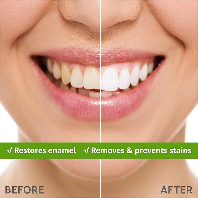 Rembrandt Deeply White + Peroxide Whitening Toothpaste Fresh Mint Flavor 2.6 Ounce (Pack of 2)