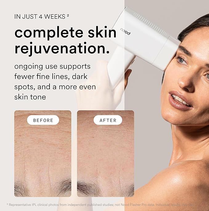 Nood??NEW Flasher Pro ? IPL Laser Hair Removal Device &amp Anti-Aging Red Light Therapy for Women &amp Men ? Pain-free Permanent Visible Results After First Use &amp Works Everywhere Hair Grows ?