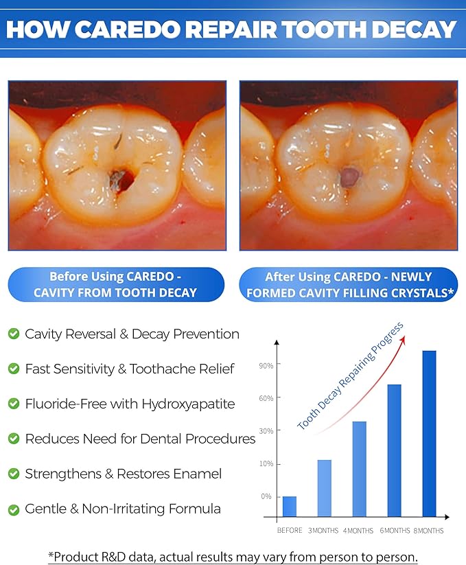 Cavity Reversal Hydroxyapatite Toothpaste for Adults Cavity Tooth Filler as Home Cavity Repair Fluoride Free Reverse Cavities Treatment for Tooth Decay Repair Remineralizing Repair 3.52OZ