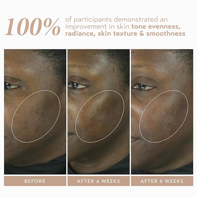 SHANI DARDEN SKIN CARE Retinol Reform with 1% Encapsulated Retinol Serum for Face &amp Neck Gentle Slow-Release Retinol Face Serum with Tripeptide for Wrinkles Fine Lines &amp Uneven Tone 0.3 fl