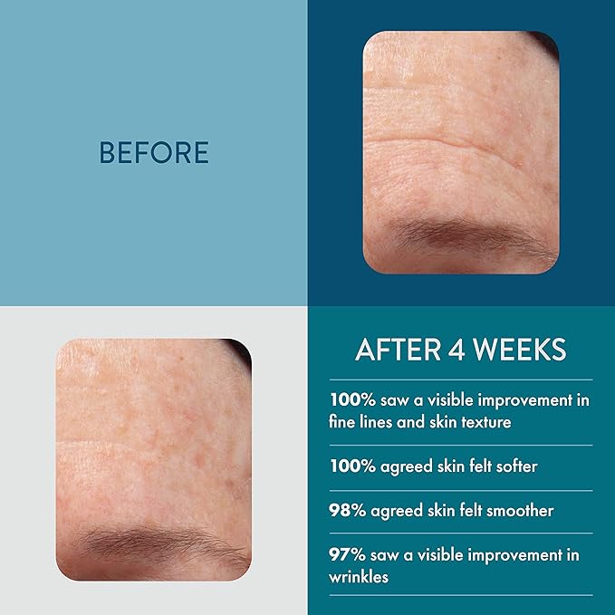 Lancer Skincare The Method: NourishSkincare for Face Facial Moisturizer for Normal or Combination Skin Bonus Size (3.4 oz)