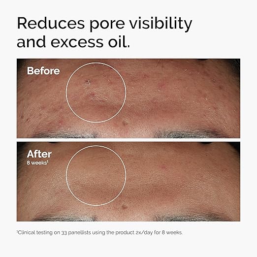 The Ordinary Serum Favorites Set ? Hyaluronic Acid 2% + B5 Niacinamide 10% + Zinc 1% Caffeine Solution 5% ? Eye and Face Serums for Hydrating Brightening &amp Pore-Minimizing Skin Care