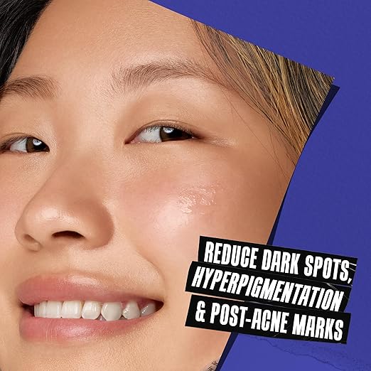 Kiehl's Clearly Corrective Dark Spot Serum Brightening Facial Serum Reduces Hyperpigmentation &amp Post-acne Marks with Vitamin C &amp Salicylic Acid All Skin Types Paraben-free Mineral Oil-fr