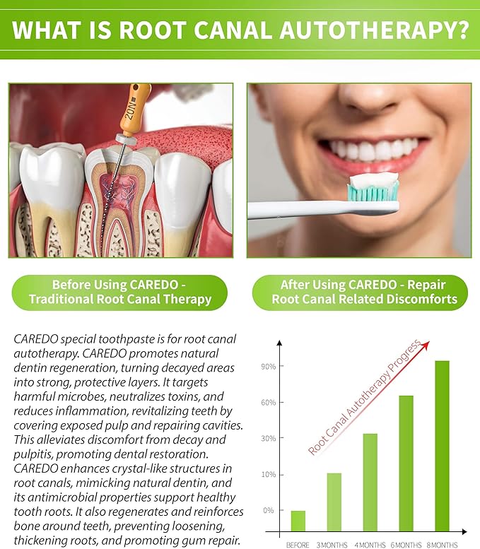 Toothpaste Gum Repair for Avoid Root Canal Therapy Gingivitis Toothpaste fit Gum Care Pulpitis Pain Mint Flavored 3.5 Oz x 2 Tubes Both fit Youth Middle-Age &amp Elders Gift