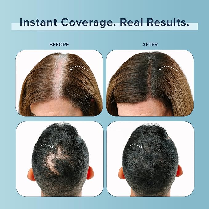 TRUHAIR Color Fibers Root Coverage and Density Booster Refill | Quick-Apply Touch Up Hair Color | Natural Matching Gray Hair Cover Up - 11 Colors Available (Medium Brown)