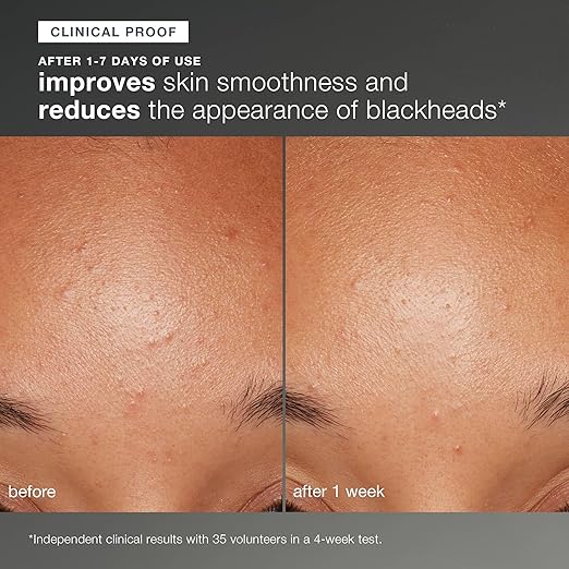 Dermalogica Daily Microfoliant Face Exfoliator Scrub Powder with Salicylic Acid and Papaya Enzyme Achieve Brighter Smoother Skin Daily