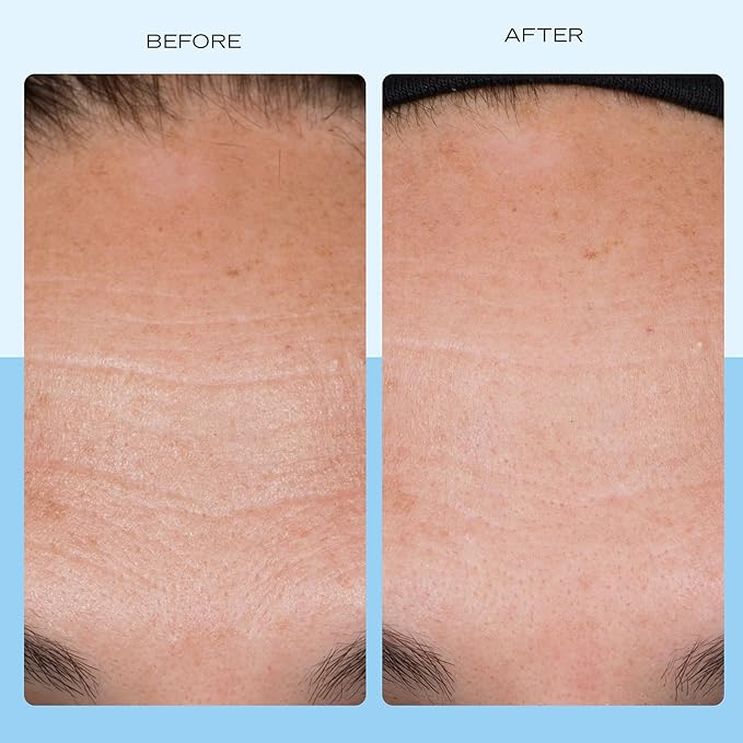 First Aid Beauty - Firming Collagen Cream with Peptides &amp Niacinamide Ultra-Rich Plumping Moisturizer Hydrates &amp Visibly Firms Non-Comedogenic Safe for Sensitive Skin 3.5 oz