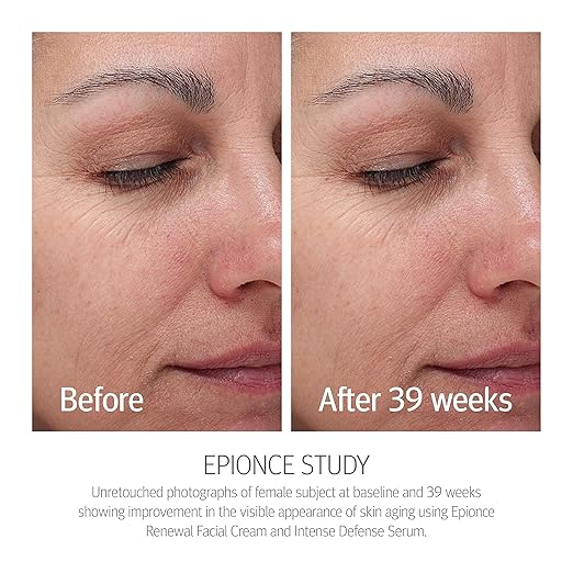 Epionce Renewal Facial Cream ? Hydrating Anti-Aging Moisturizer | For Dry Sensitive to Normal Skin | Fine Lines &amp Wrinkles | Dermatologist Skincare