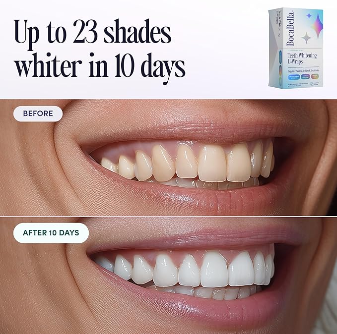 Teeth Whitening U-Wraps ? 10 Treatments ? 15% Hydrogen Peroxide Enamel-Safe No Harsh Sensitivity ? Patented Strip Design with Aloe Calendula &amp Peppermint ? Fast Even Whitening
