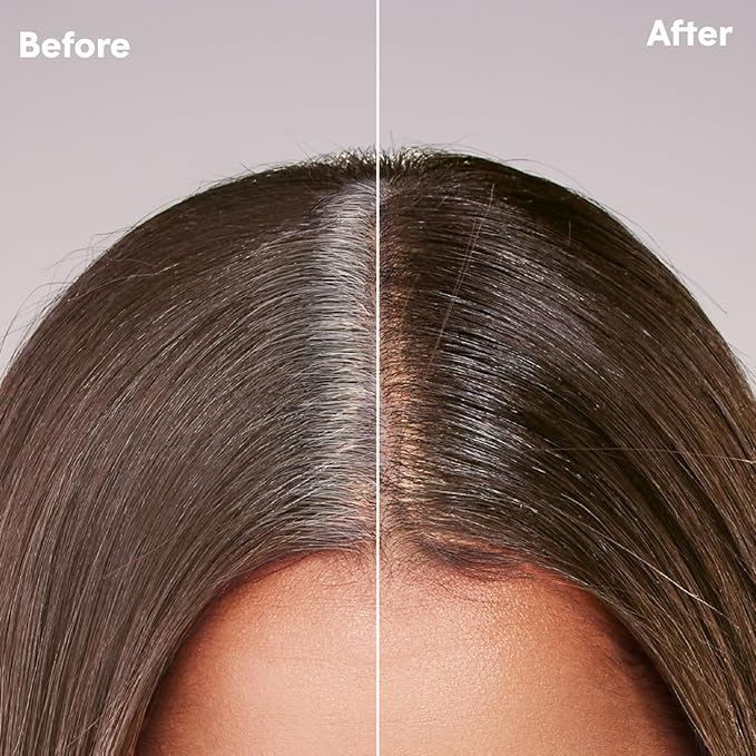 dpHUE Root Touch-Up Kit for Resistant Grays Light Brown - Permanently Cover Difficult Stubborn Gray Hair - 2 Applications Included - Vegan &amp Leaping Bunny Certified