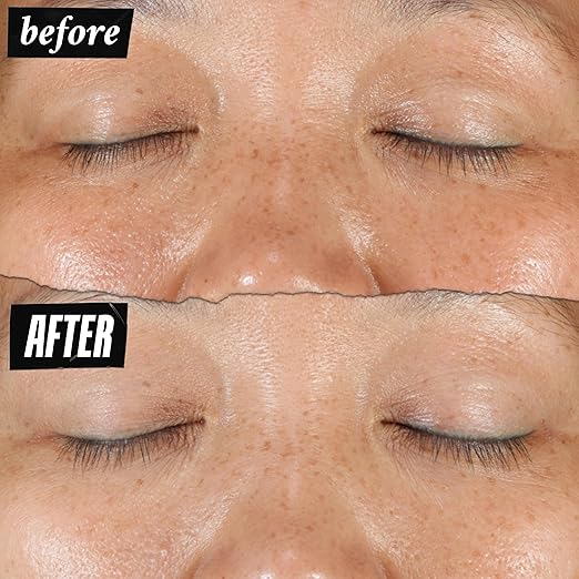 Kiehl's Clearly Corrective Dark Spot Serum Brightening Facial Serum Reduces Hyperpigmentation &amp Post-acne Marks with Vitamin C &amp Salicylic Acid All Skin Types Paraben-free Mineral Oil-fr