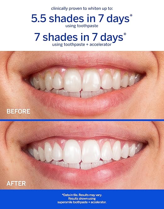 Supersmile Awake/Relax ? Fluoride Free Toothpaste for Visibly Whiter Teeth and an Energizing Start to The Day ? Whitens Up to 6 Shades 4.2 oz