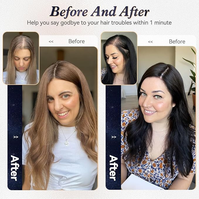 starluck Hair Toppers for Women Real Human Hair 4.5*1.5Silk Base ombre Blonde mix Brown HairPieces No Bangs 100% Real Human HairToppers for Women with ThinningHair Cover Gray Roots
