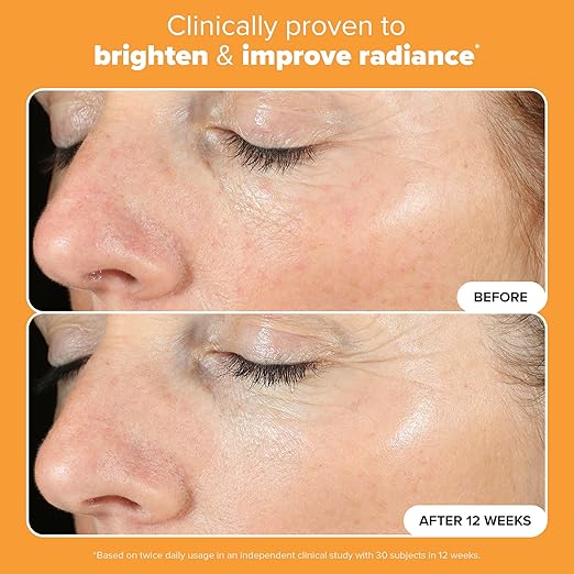 Paula's Choice BOOST C15 Super Booster 15% Vitamin C Serum for Face Face Serum with Vitamin E &amp Ferulic Acid for Discoloration &amp Glow Fragrance-Free 0.67 Fl Oz