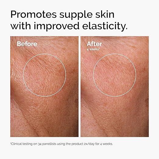 The Ordinary Serum Favorites Set ? Hyaluronic Acid 2% + B5 Niacinamide 10% + Zinc 1% Caffeine Solution 5% ? Eye and Face Serums for Hydrating Brightening &amp Pore-Minimizing Skin Care