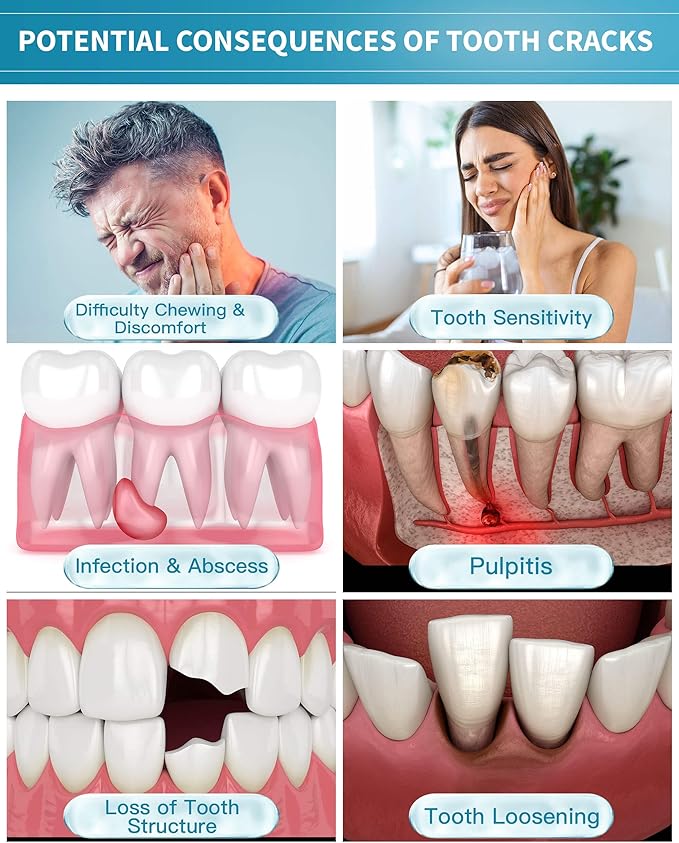 Healing Teeth Crack Toothpaste The ONLY Toothpaste Repairing Cracked Teeth Enamel Cracks Cure Tooth Sensitivity Remove Pigment in Crack 100g 2 Counts As Mother's Day Gift