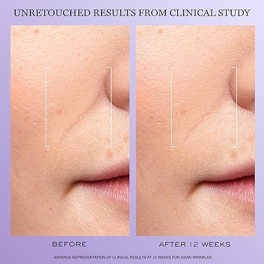 Lanc?me R?nergie H.C.F. Triple Serum - Hyaluronic Acid Serum for Visible Correction of Anti Aging Signs &amp Dark Spots - With Vitamin C+ Niacinamide &amp Ferulic Acid