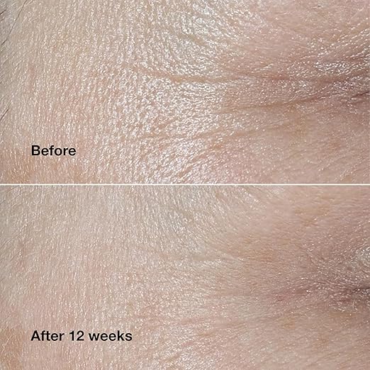 Clinique Smart Clinical Repair Wrinkle Correcting Anti Aging Face Cream With Hyaluronic Acid + Peptides For All Skin Types | Hydrating