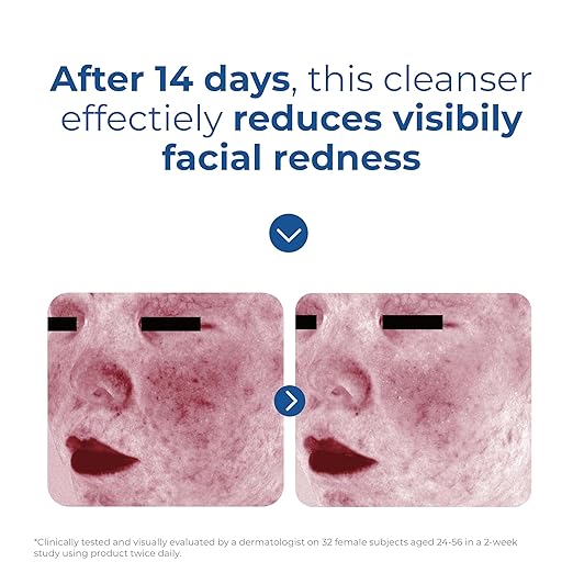 EltaMD Skin Recovery Amino Acid Foaming Facial Cleanser Gentle Face Cleanser for Sensitive Skin