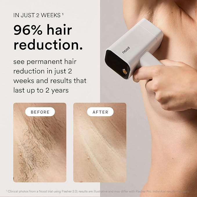 Nood??NEW Flasher Pro ? IPL Laser Hair Removal Device &amp Anti-Aging Red Light Therapy for Women &amp Men ? Pain-free Permanent Visible Results After First Use &amp Works Everywhere Hair Grows ?