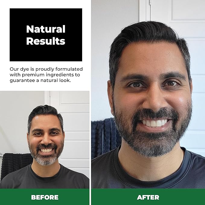 Simpler Partial Coverage Men's Hair Color Color Box - Permanent Beard and Mustache Dye - Ammonia-Free Beard Hair Dye ? Fast Gray Blending ? Salt &amp Pepper Look - Lighter Shades