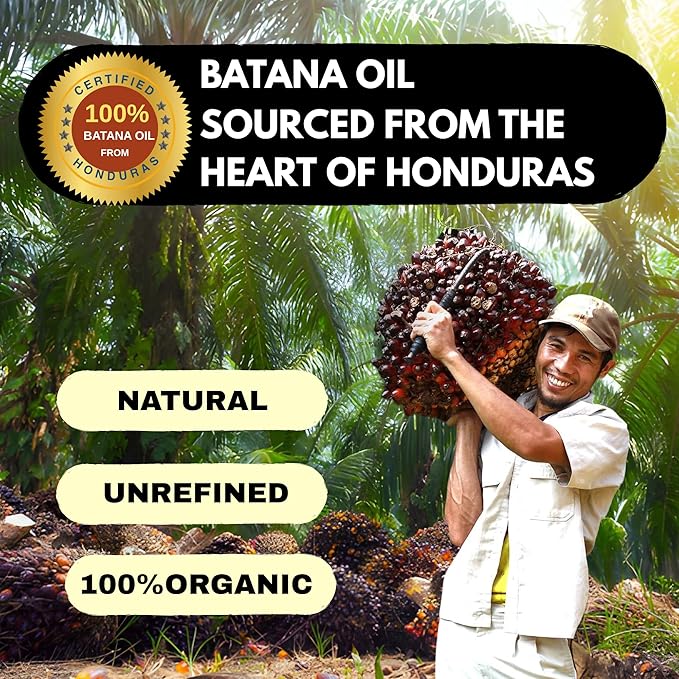 100% Raw Batana Oil ? Unrefined from Honduras Promotes Hair Growth Thickness and Prevents Hair Loss. Suitable for Both Men and Women. A Natural Hair Growth Oil - 4.05 fl.oz