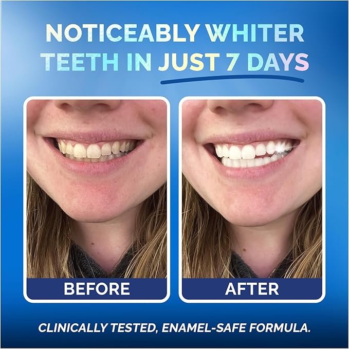 Whitening Strips for Sensitive Teeth 14 Treatments Coconut ? Enamel Safe Peroxide-Free Coconut Teeth Whitening Strips with Natural Enzymes ? Gentle White Stips for Sensitive Gums &amp Daily Oral Ca