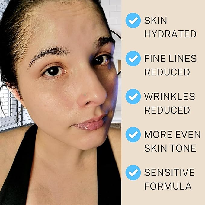 SKIN AURA??Advanced Anti-Aging Serum | All-In-One Sensitive Formula for Wrinkles Fine Lines &amp Age Spots | Plant Derivative with Hyaluronic Acid Collagen Peptides 5 Vitamins + Minerals - 30ml (1