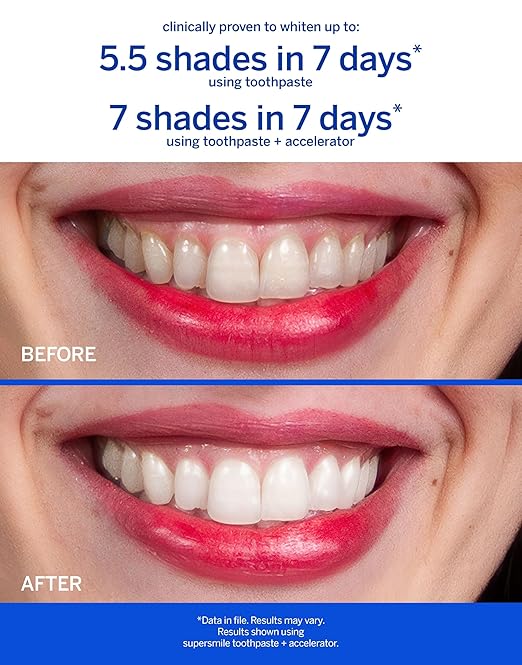 Supersmile Professional Teeth Whitening Toothpaste - Fluoride Free for Visibly Brighter Smile - Whitens up to 6 Shades
