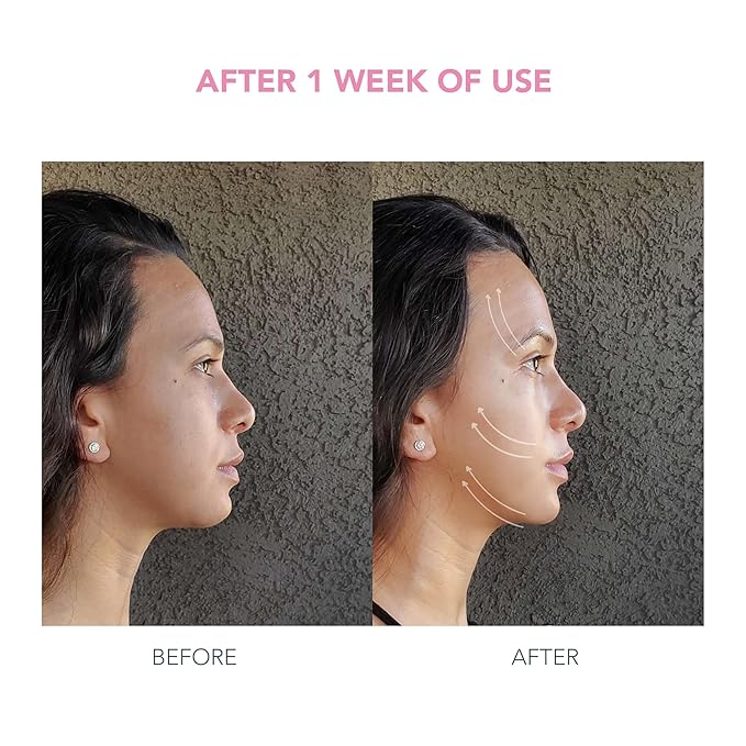 FOREO Firm &amp Fabulous BEAR mini + Serum Serum Serum 1 Oz Anti aging Starter Kit- Microcurrent Facial Device- Instant Face Lift- Double Chin Eliminator- Facial Skin Care Products- Gift Set- Pearl P