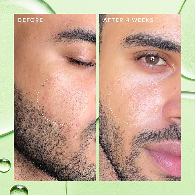 Farmacy 2% Salicylic Acid Toner for Face - Deep Sweep Gentle BHA Exfoliant for Oily Skin - Refines Texture with Papaya Enzymes &amp Moringa Water for a Healthy-Looking Complexion (120ml)