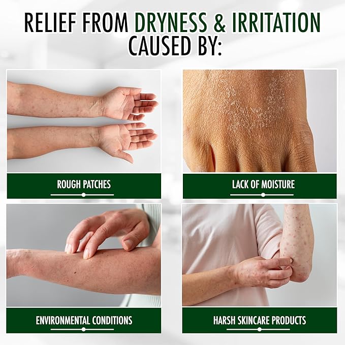 GLY MIRACLE Moisturizing Body Cream Lotion 16 ounce - Non-Greasy Skin Humectant for Extremely Dry Skin Hands Body and Feet Fragrance-Free with Pure Glycerin for Nourishing Hydration.