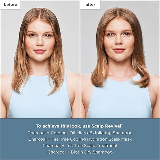 Briogeo Scalp Revival Charcoal + Tea Tree Cooling Hydration Scalp Mask Dry Scalp Treatment and Moisturizer Soothes a Dry Flaky Itchy Scalp Treatment for Oily Scalp Vegan Cruelty-Free 6 fl oz