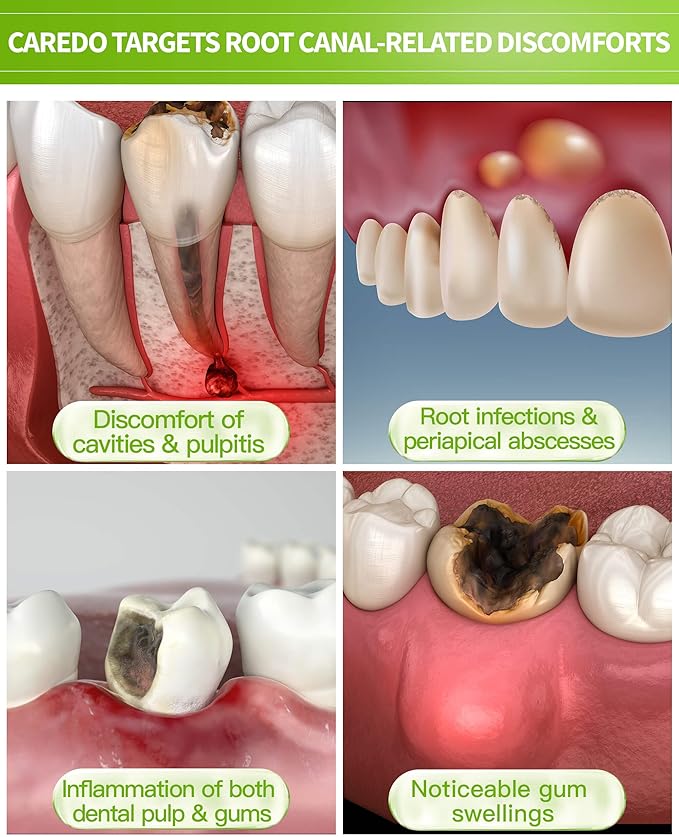 Toothpaste Gum Repair for Avoid Root Canal Therapy Gingivitis Toothpaste fit Gum Care Pulpitis Pain Mint Flavored 3.5 Oz x 2 Tubes Both fit Youth Middle-Age &amp Elders Gift