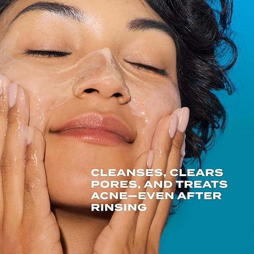 Murad Clarifying Cleanser ? Salicylic Acid &amp Green Tea Formula for Acne Deep Pore Cleansing Oil Control &amp Breakout Prevention for Clear Balanced Healthy-Looking Skin ? 5 Fl Oz