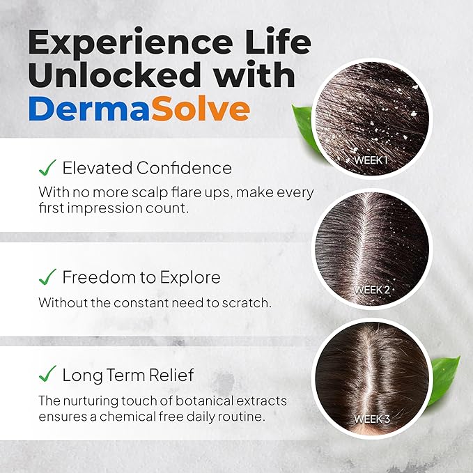 DermaSolve Scalp Psoriasis &amp Dandruff free Medicated Shampoo with Conditioner Ultimate Seborrheic Dermatitis Treatment for Itchy Flakey Scalp Soothing &amp Moisturizing Relief