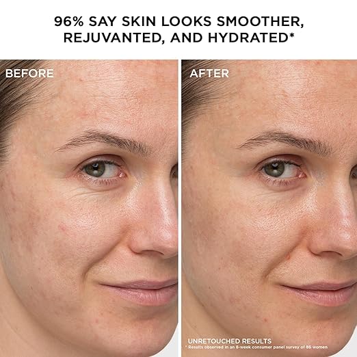 IT Cosmetics Confidence in a Cream - Hydrating &amp Anti Aging Face Moisturizer Visibly Reduces Fine Lines &amp Wrinkles Up To 48H Hydration Repairs Skin Barrier Squalane &amp Ceramides For Al
