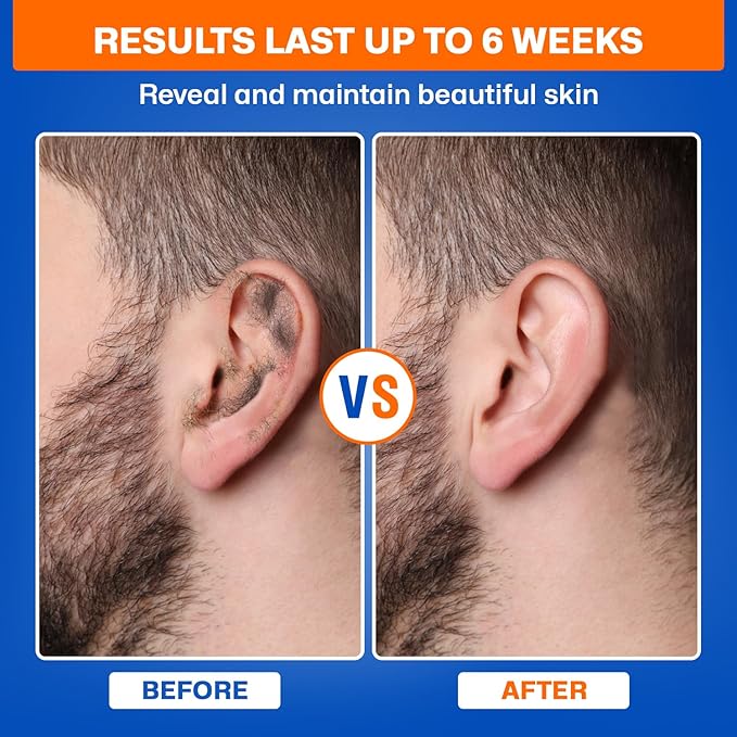 2-in-1 Ear &amp Nose Waxing Kit for Men &amp Women | 100g Hair Removal Wax + 99pc | 20 Applicators 10 Nasal Sticks 15 Wipes &amp 20 Earplugs | No Microwave Needed | Nose Wax Kit Ear Hair Remover