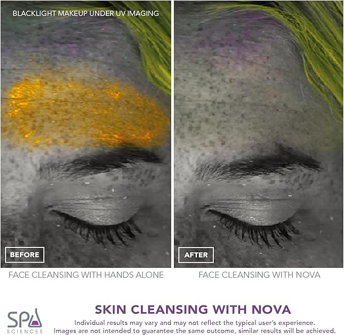 Spa Sciences - NOVA - Sonic Cleansing Brush with Bristles &amp Infusion System ? Anti-Aging Facial Exfoliating Waterproof and USB Rechargeable