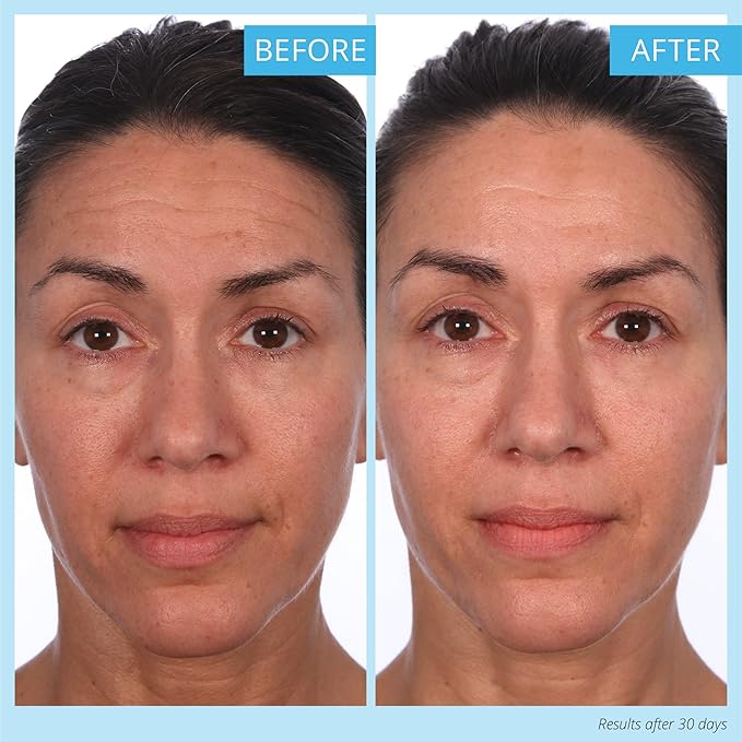 SKINN Cr?me Reverse with Ferulic Acid Retinol and Vitamin C-Cr?me Reverse Intensive-Anti-Aging Cream with Hyaluronic Acid to Plump Skin Vitamin C Help to Improving Tone Firmness of Skin