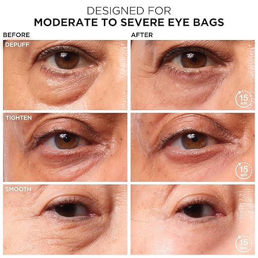 IT Cosmetics Bye Bye Under Eye Bags Treatment For Women &amp Men ? Temporary Eye Bag Reducer &amp Undereye Corrector Depuffs Tightens Smooths &amp Reduces Look of Wrinkles &amp Fine Lines - 0.5