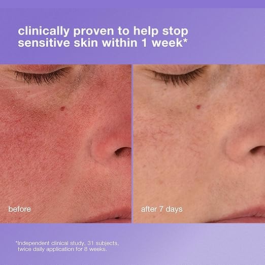 Dermalogica Stabilizing Repair Cream Face Moisturizer for Sensitive Skin with Cica - Strengthens Soothes and Repairs Skin Barrier