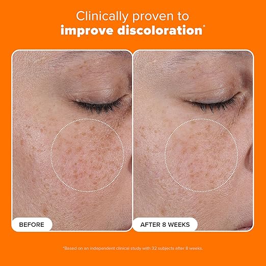 Paula?™s Choice 25% Vitamin C Serum with Glutathione &amp Antioxidants Face Serum Improves Discoloration Uneven Tone &amp Firms All Skin Types Fragrance-Free 1oz