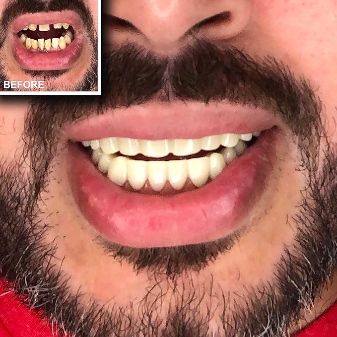 Instant Smile Comfort Fit Flex Teeth - Upper and Lower Matching Set Natural Shade! Fix Your Smile at Home Within Minutes!