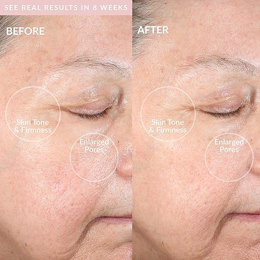 Clean Pro OB - Smart Facial Cleansing Device