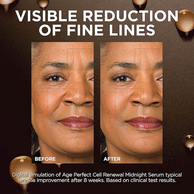 L'Oreal Paris Age Perfect Anti-Aging Midnight Face Serum Reduce Wrinkles 1oz + Eye Cream Sample