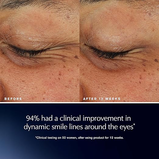 Est?e Lauder Advanced Night Repair Eye Lift + Sculpt | Eye Cream with 2HA Volume Filler &amp Hexapeptide-8 0.5 Fl Oz