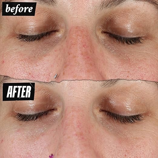Kiehl's Clearly Corrective Dark Spot Serum Brightening Facial Serum Reduces Hyperpigmentation &amp Post-acne Marks with Vitamin C &amp Salicylic Acid All Skin Types Paraben-free Mineral Oil-fr